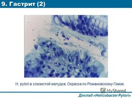 Биоптат слизистой желудка