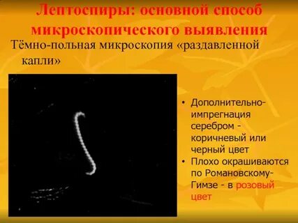 Лептоспиры