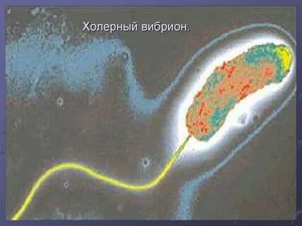 Холера в воде