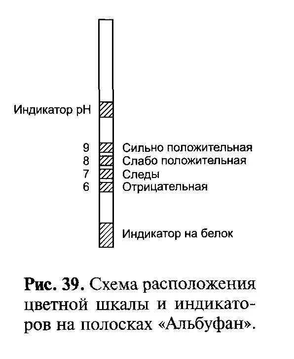 Качественное определение белка в моче. Измерение сахара в моче. Тест на белок в моче. Полуколичественный метод определения Глюкозы в моче. Белок качественно в моче