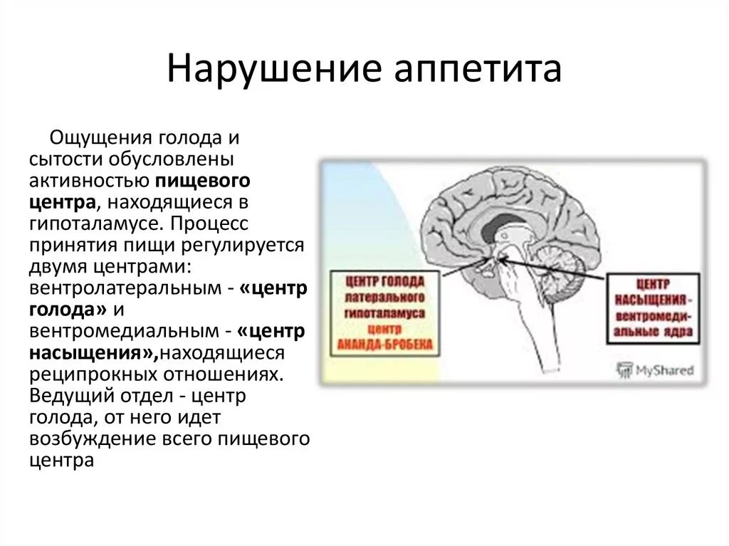 Центр голода в головном мозге