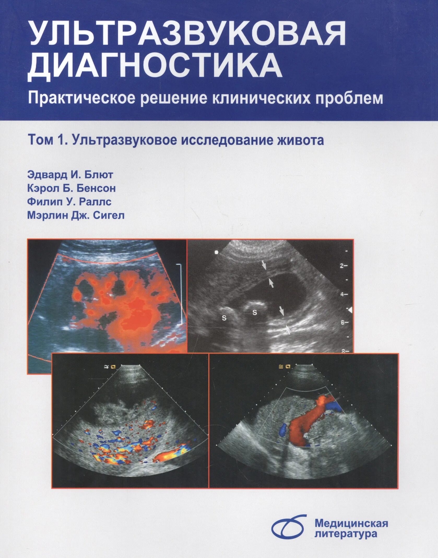 Ультразвуковая диагностика блют. Ультразвук в диагностике. Книги по эфи диагностике. Ультразвуковая диагностика книги