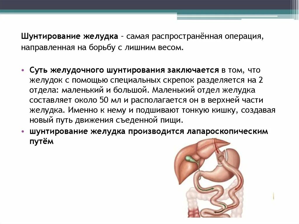 Операция шунтирование желудка. Бариатрическая операция шунтирование желудка. Шунтирующая операция на желудке это.