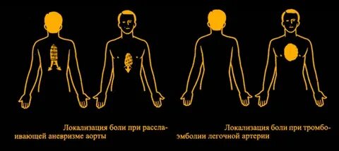 Боль в грудине солнечное сплетение