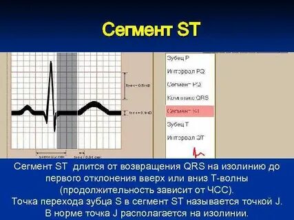 Высокий st