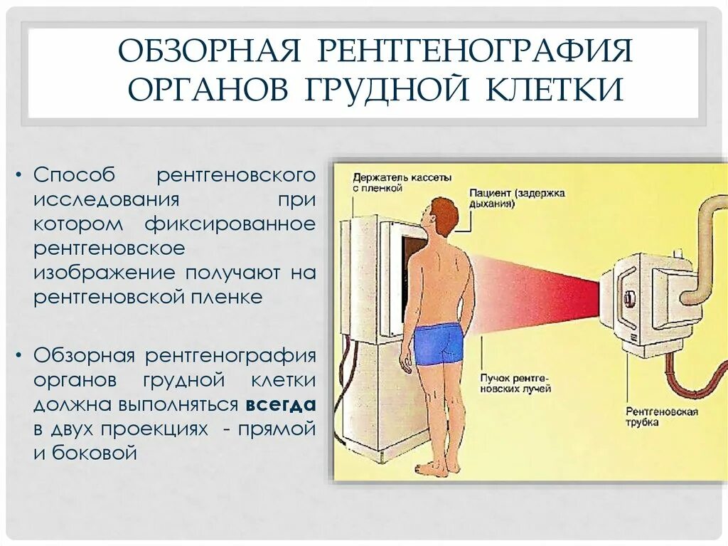 Рентген можно сделать. Рентген исследование грудной клетки. Обзорная рентгенография органов грудной клетки показания. Подготовка пациента к рентгенографии органов грудной клетки. Подготовка к рентгенографии органов грудной клетки.