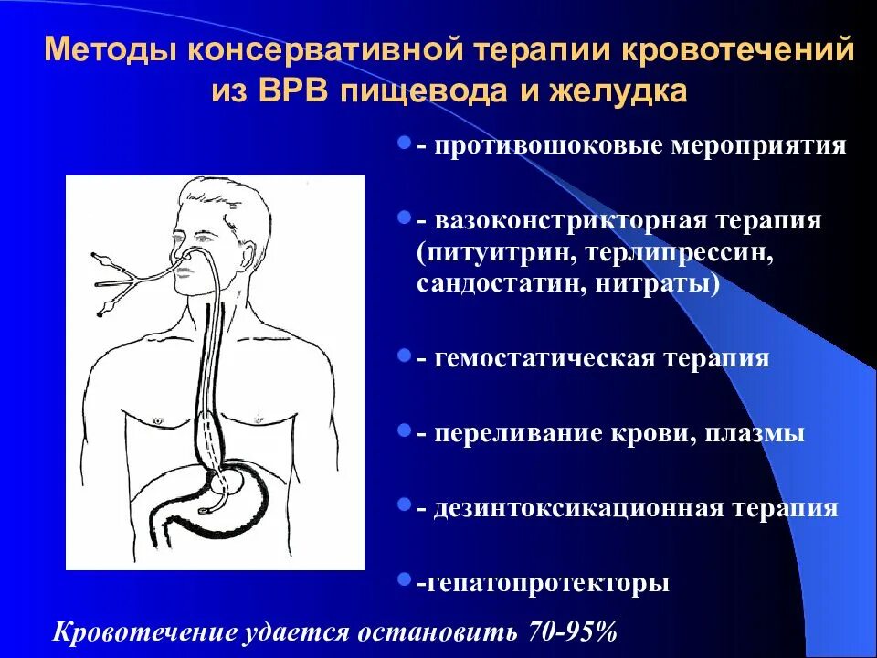 Методы остановки кровотечения из варикозно расширенных вен пищевода. Кровотечение из варикозно расширенных вен пищевода. Пищеводно-желудочные кровотечени. Способы остановки кровотечения из варикозных вен пищевода. Остановка кровотечения из расширенных вен пищевода