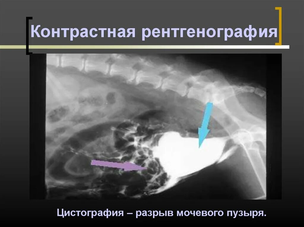 Контрастная рентгенография. Контрастная рентгеноскопия. Контрастная рентгенография. Контрастная рентгеноскопия. Контрастность на рентгене.