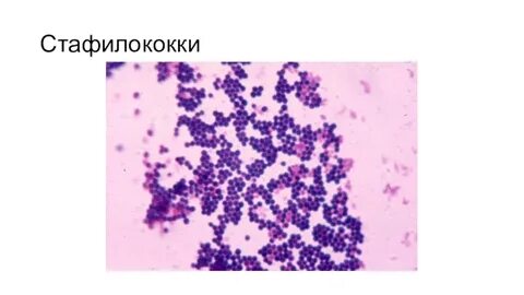 Стафилококк эпидермидис в мазке