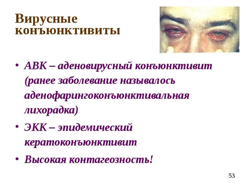 Аденовирусный кератоконъюнктивит. Аденовирусный конъюнктивит глаз. Аденовирусный конъюнктивит симптомы. Вирусный конъюнктивит симптомы.