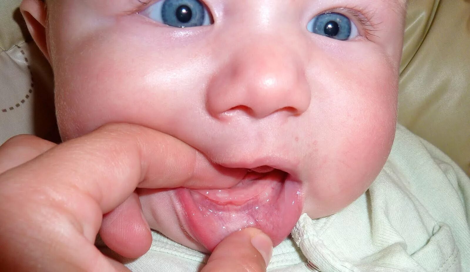 Первый зуб возраст. Десны у новорожденных при прорезывании зубов. Десна при прорезывании зубика. Демна при прорезываниизубов.