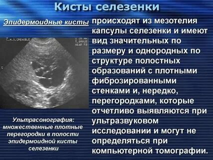 Увеличенная печень причины симптомы лечение