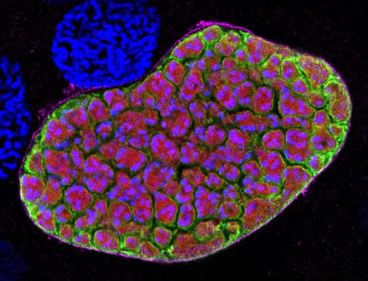 Клетки печени в дистиллированной воде. Plasmodium berghei. Многоядерные клетки печени. Малярийный плазмодий.