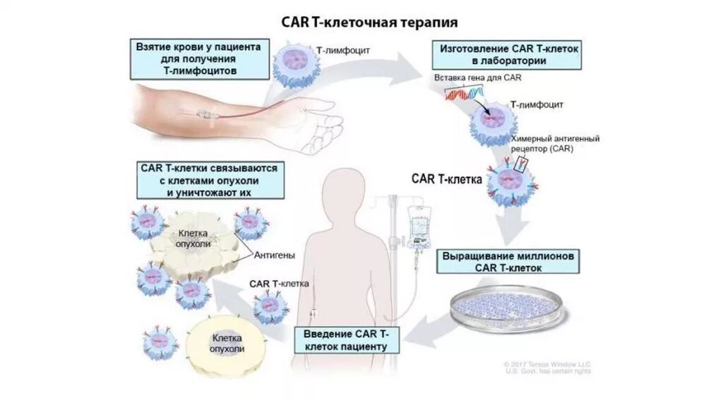 Car-t терапия. Клеточная терапия. Клеточная терапия в онкологии. Кар т клетки терапия. Все клетки больного мужчины имеют 47