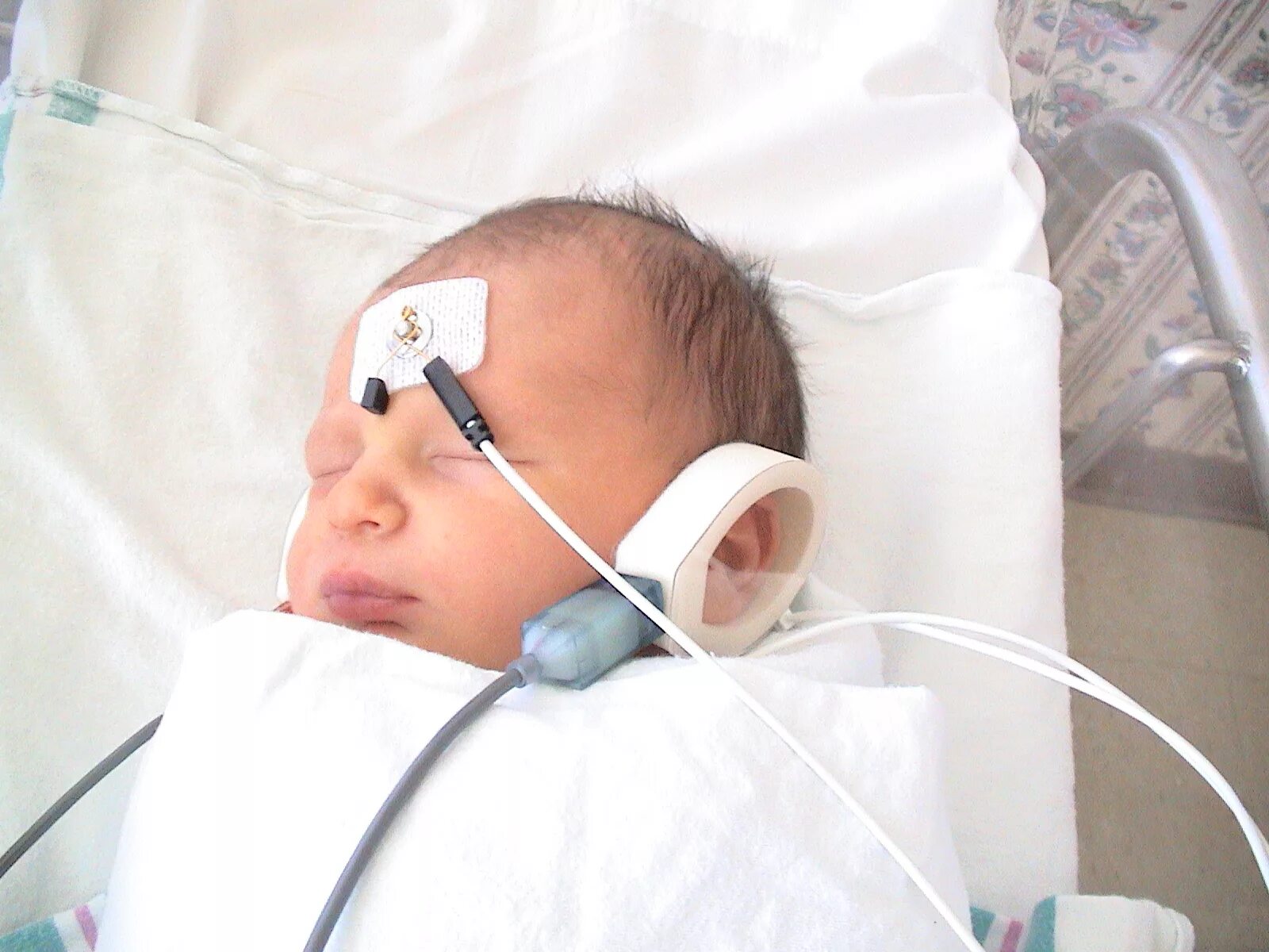 Прибор отоакустической эмиссии. Аудиоскрининг новорожденных. Скрининг слуха новорожденных. Аудиологический скрининг. Аудиологический скрининг новорожденных.
