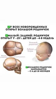 Что такое родничок у новорожденного на голове