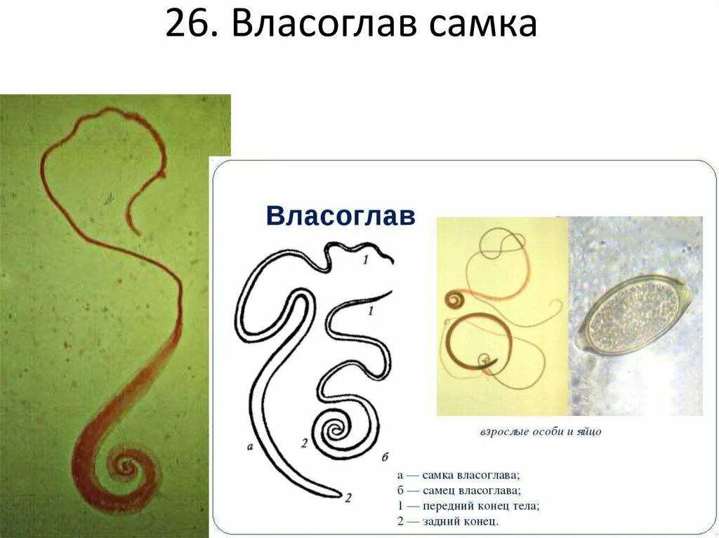 Власоглав самец и самка препарат. Власоглав Trichocephalus Trichiurus. Власоглав самка и самец рисунок. Самка власоглава препарат.