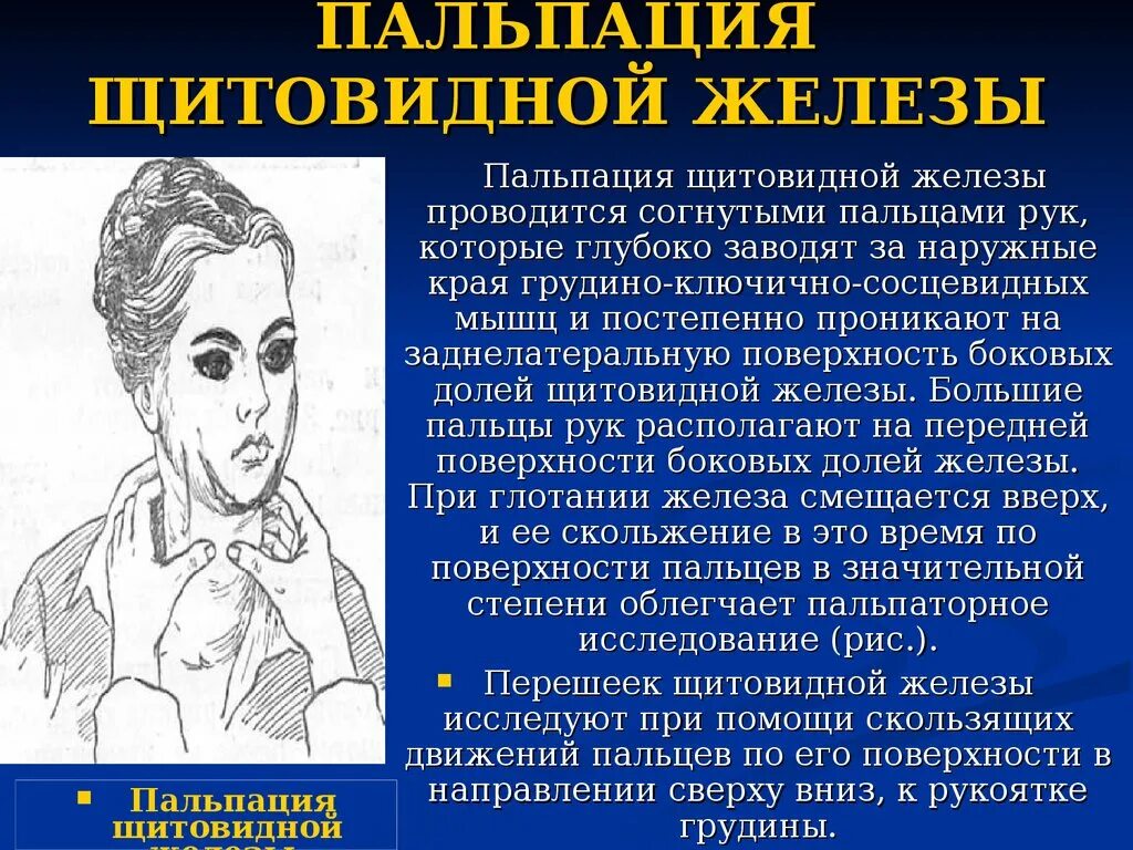 Как прощупать щитовидную железу
