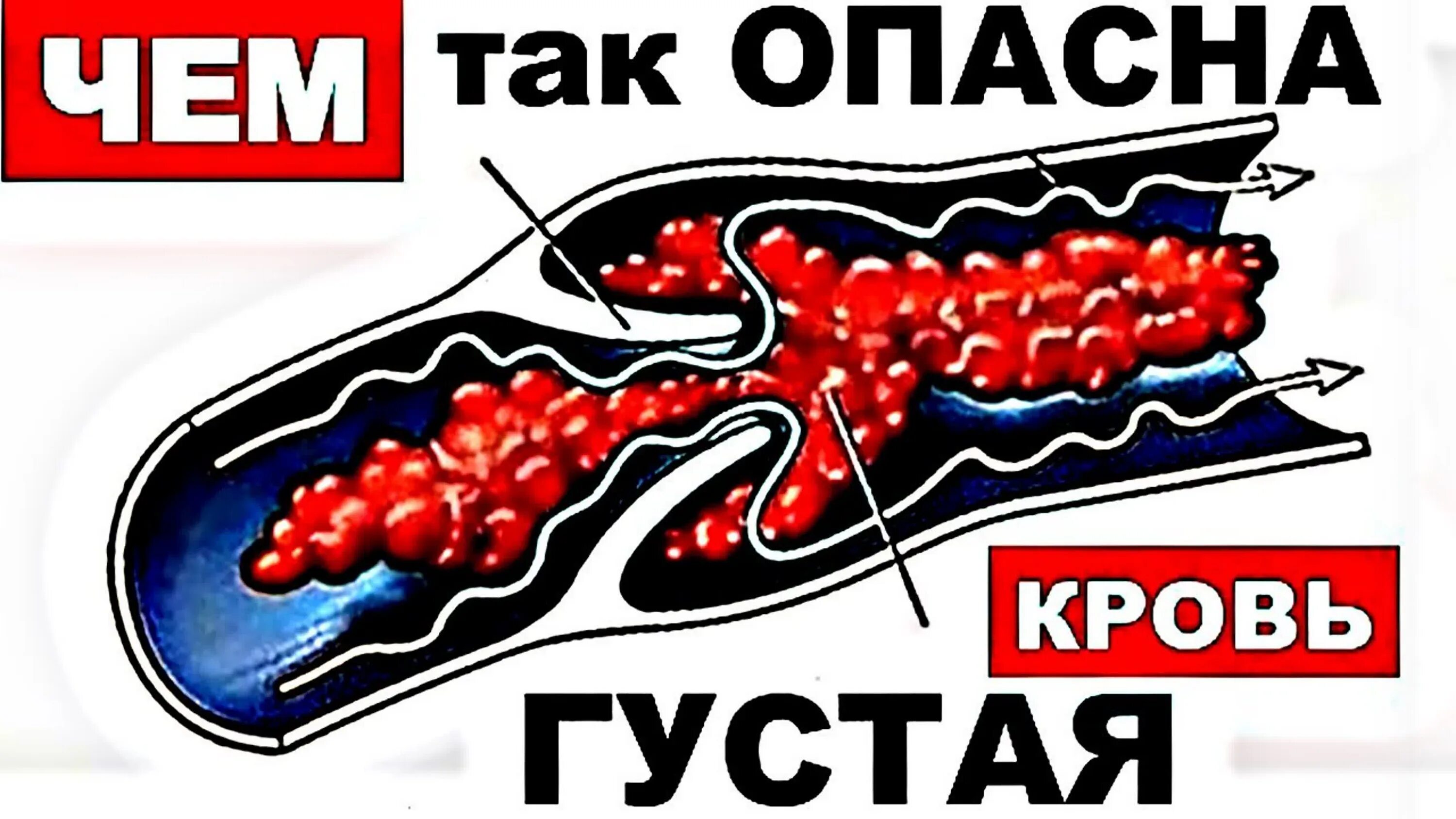 Густая кровь форум. Опасность густой крови. Чем опасна густая кровь.