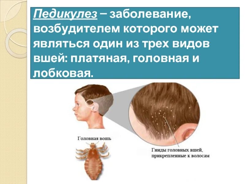 Вши какое заболевание. Педикулез презентация. Заболевание педикулез. Педикулез симптомы и профилактика. Профилактика головного педикулеза.