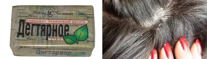 Помогает от перхоти мыло. Мыть голову хозяйственным мылом. Мыло с березовым дегтем. Мыло для мытья волос. Помогает от перхоти мыло.