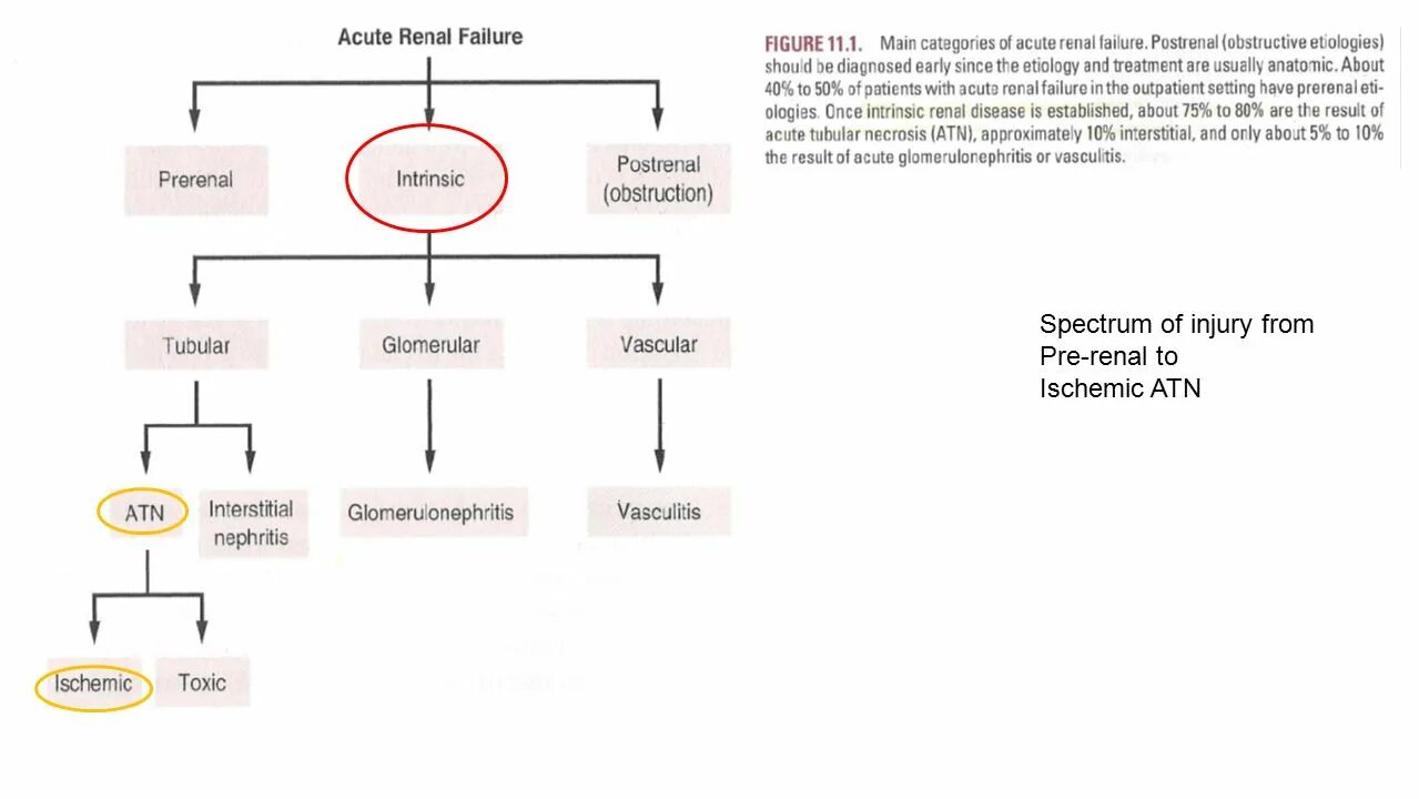 Acute перевод. Acute renal failure. Acute Toxic renal. Acute Toxic renal failure with Tubular necrosis.