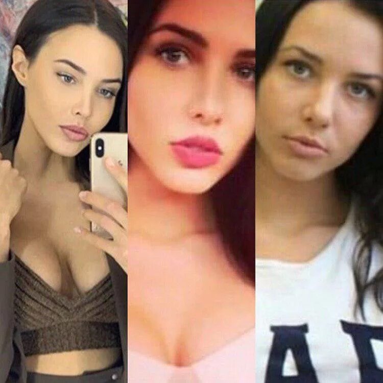 Анастасия решетова до пластики. Пластика решетовой до и после. Анастасия решетова пластики. Анастасия решетова пластика носа. Пластика решетовой до и после.