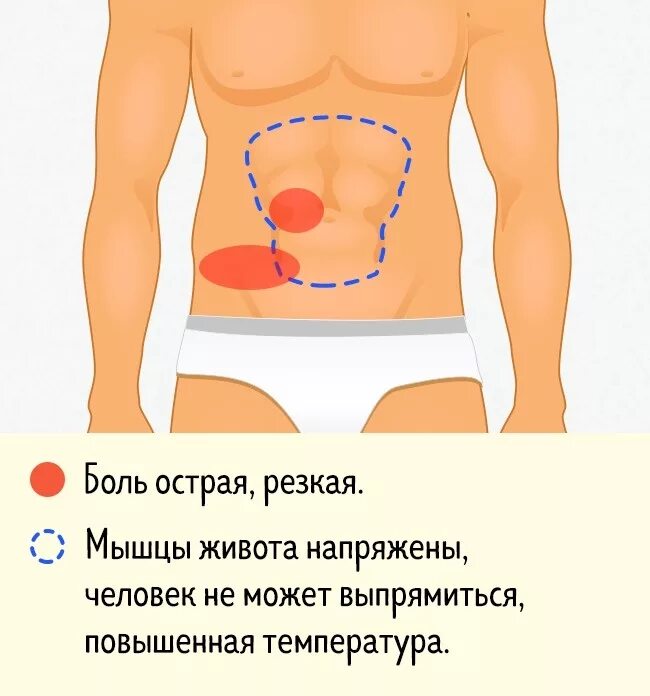 Почему колет внизу живота. Локализация боли в животе. Болит вся область живота. Рези возле пупка. Болит справа посередине живота.