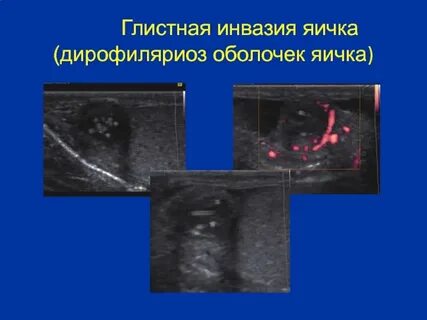 Перекрут карта