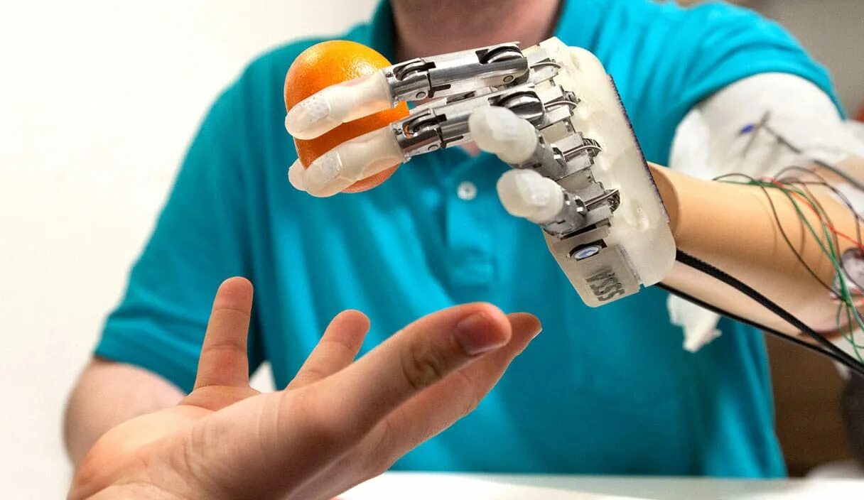 Бионические протезы. Touch Bionics протезы. Бионический протез Bionic. Роботизированные протезы в медицине.