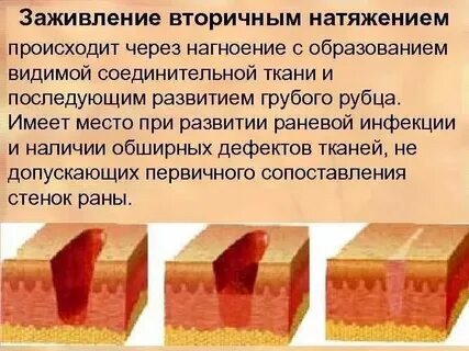 Через сколько заживает ранка