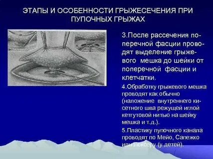 Возникновение грыжи