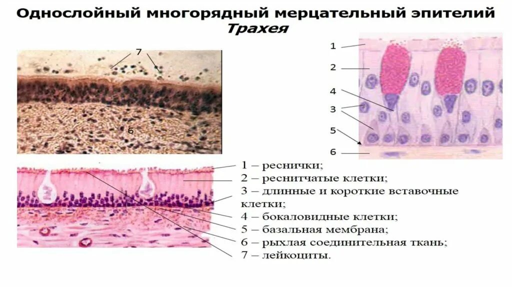 Эпителиальные ткани состоят из клеток. Многослойный неороговевающий эпителий. Эпителиальная ткань лекция. Опухоли из эпителиальной ткани. Эпителиальные клетки кожи.