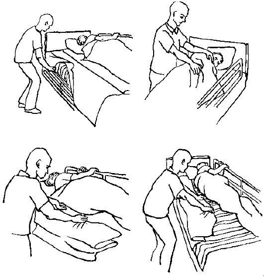 Смена тяжелобольных. Продольный способ смены постельного белья тяжелобольному. Алгоритм смены постельного белья больных. Смена постельного белья тяжелобольному пациенту продольный способ. Смена постельного белья тяжелобольному алгоритм.