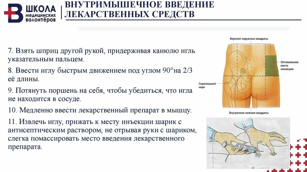 На сколько вводить укол в ягодицу. Постановка внутримышечной инъекции алгоритм. Внутримышечная инъекция алгоритм укол. Внутримышечная инъекция верхний Квадрант. Схема выполнения внутримышечной инъекции.