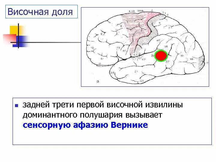 Сенсорная афазия вернике. Поражение задней трети верхней височной извилины. Нейрофизиологические основы речи. Строение лобной доли головного мозга. Передняя центральная извилина лобной доли.