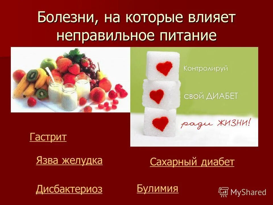 на что влияет неправильный. на что влияет неправильный. правильная осанка. признаки не правильннойосанки. миофасциальные цепи кинезиология.