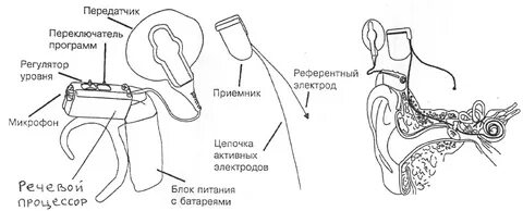 Принцип слухового аппарата