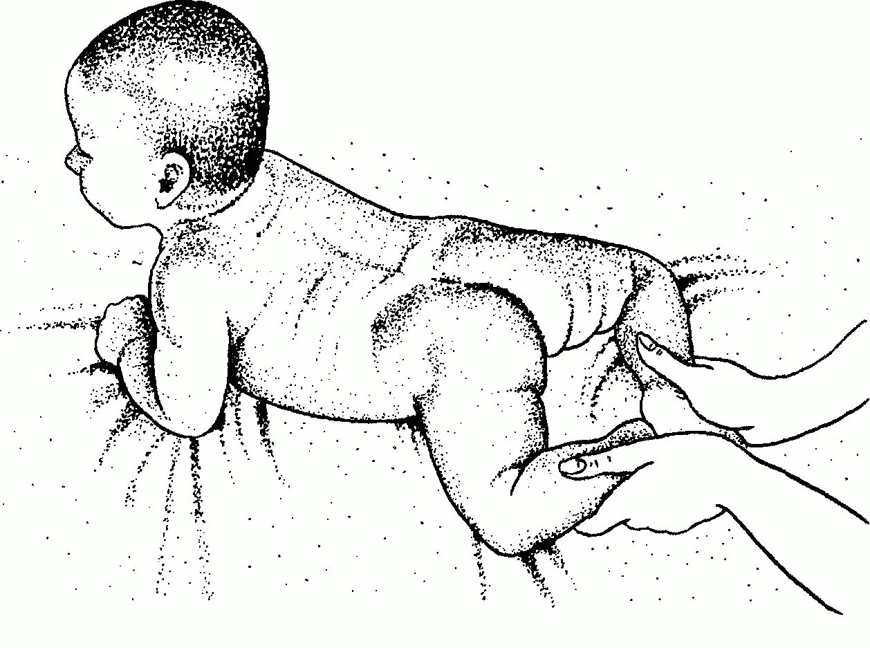 Рефлекс упражнение. Рефлекс ползания Бауэра. Рефлекс ползания (Бауэра) и спонтанное ползание. Рефлекс Бауэра у новорожденного. Рефлекс ползания (рефлекс Бауэра).