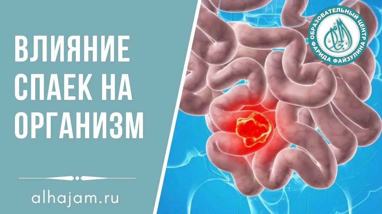 Профилактика спаечного процесса. Профилактика образования спаек. Спаечный процесс в брюшной полости.