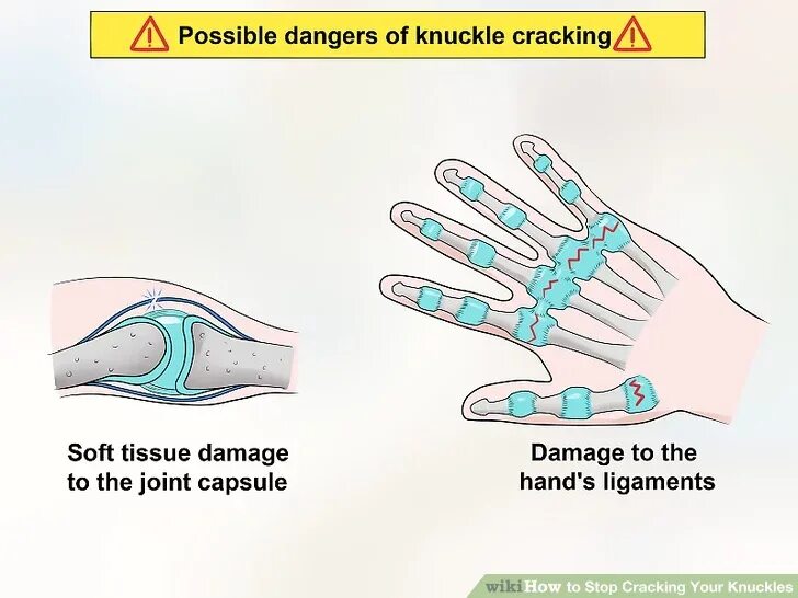 Причины хрустишь пальцами. Хрустеть пальцами вредно. Можно хрустеть пальцами на руках