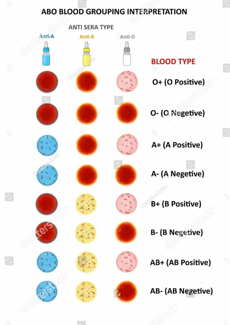Blood group b. Blood types. Ab blood type. Группа блуд. Blood types.