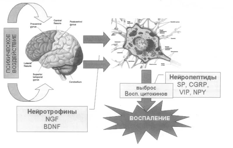 Бронхиальная астма психосоматика. Механизм возникновения психосоматических болезней. схема развития психосоматического заболевания. бронхиальная астма психосоматика заболевания. механизм возникновения бронхиальной астмы психосоматика.
