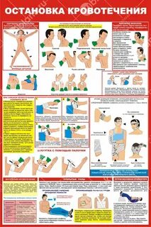 Кровотечение обж 8 класс