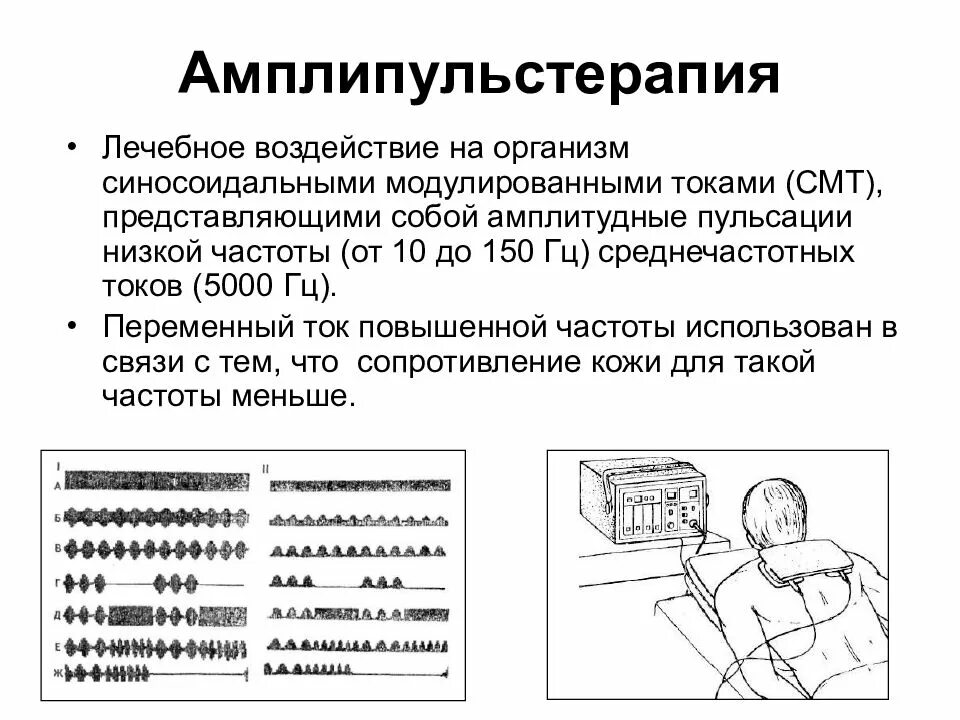 Синусоидальные модулированные токи методика проведения. Амплипульс терапия механизм действия. Аппарат амплипульс физиотерапии электрофореза. Амплипульс методики наложения электродов. Закон низкой частоты