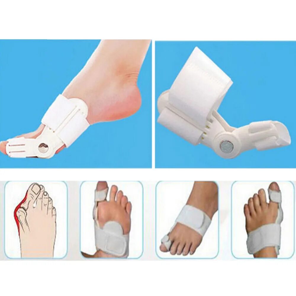 Халюс вальгус фиксатор. Бандаж-шина Bunion Aid Hinged Splint for Bunions корректор большого пальца. Корректор халлюкс вальгус. Шина для халюкс вальгус. Ортопедическая операция ног