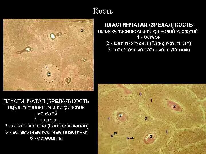 Пластинчатая кость