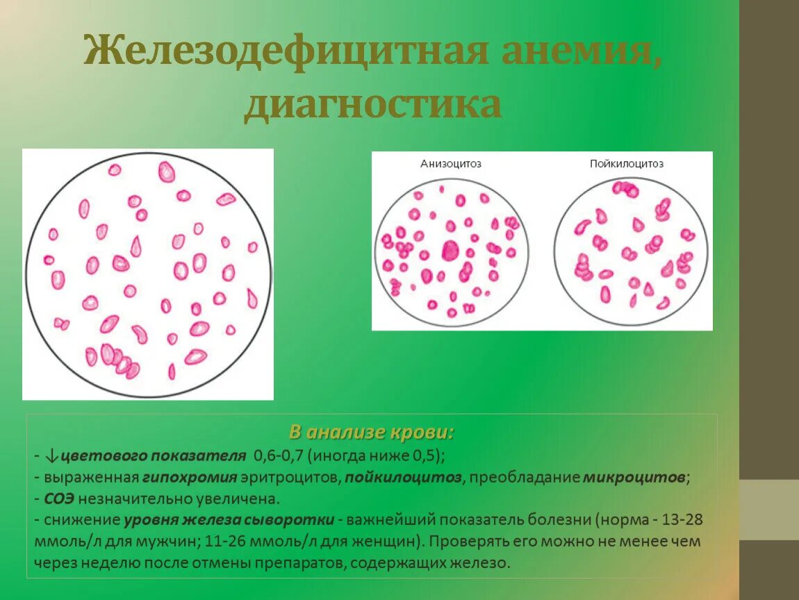 Пойкилоцитоз анемия. Микроцитоз анизоцитоз пойкилоцитоз. Пойкилоцитоз формы эритроцитов. Пойкилоцитоз анизоцитоз анемия. Антхоцитоз ройеилоциооз.