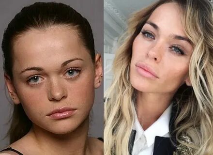 Давай после пластики