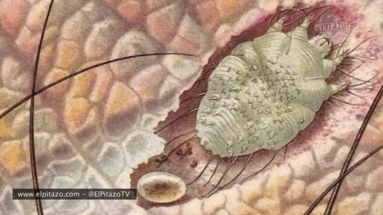 Épinglé sur Phytothérapie